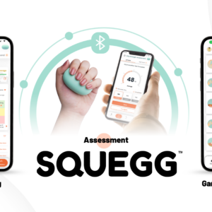 Squegg - Smart Dynamometer & Hand Grip Trainer